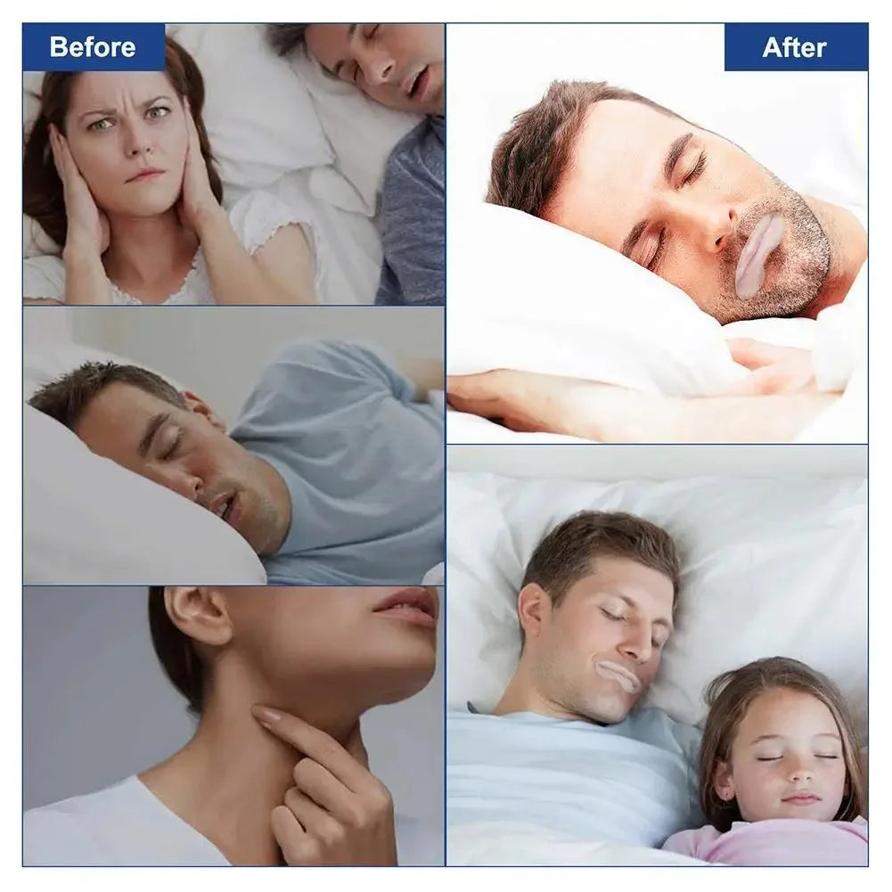 Anti Snoring Sleep Strips